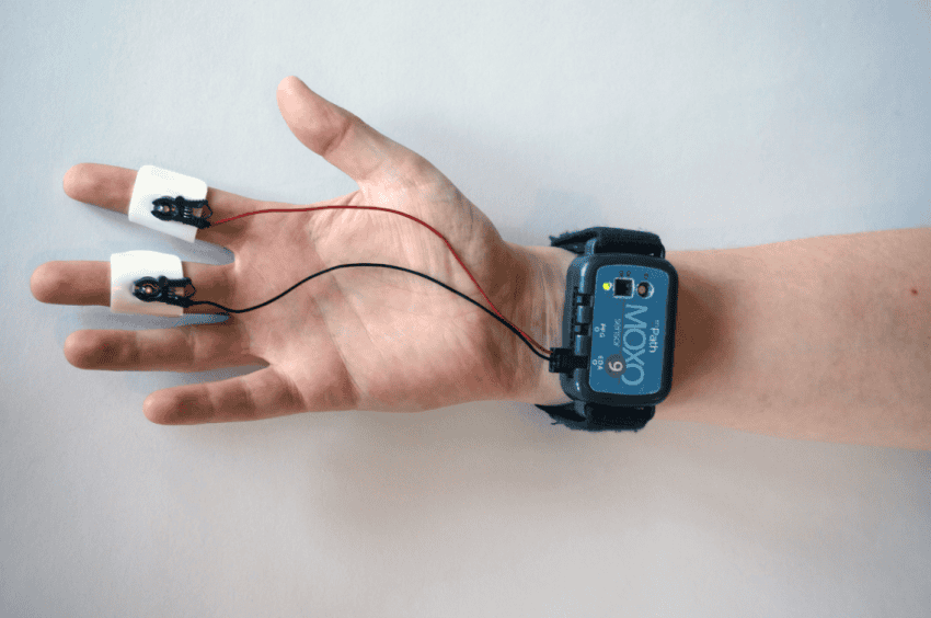 Teknologi Seluler dalam Pengembangan Teknologi Wearable dan Kesehatan Digital